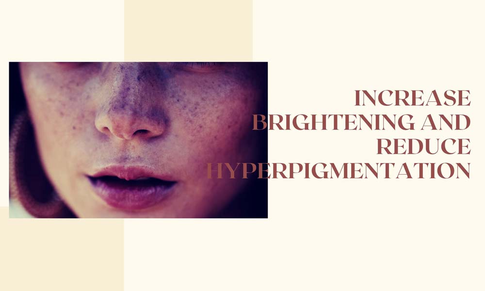 Increase brightening and reduce hyperpigmentation • What Is Niacinamide? Everything you must know for glowing skin.