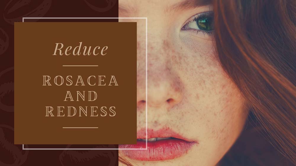 reduce rosacea and redness • What Is Niacinamide? Everything you must know for glowing skin.