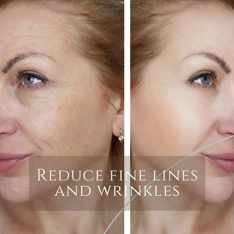 Reduce fine lines and wrinkles